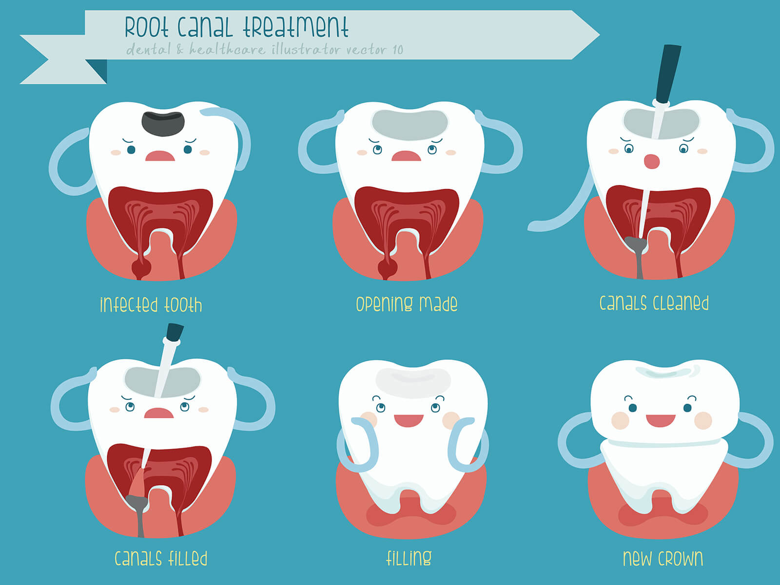 How Does Root Canal Therapy Treat Decayed Teeth