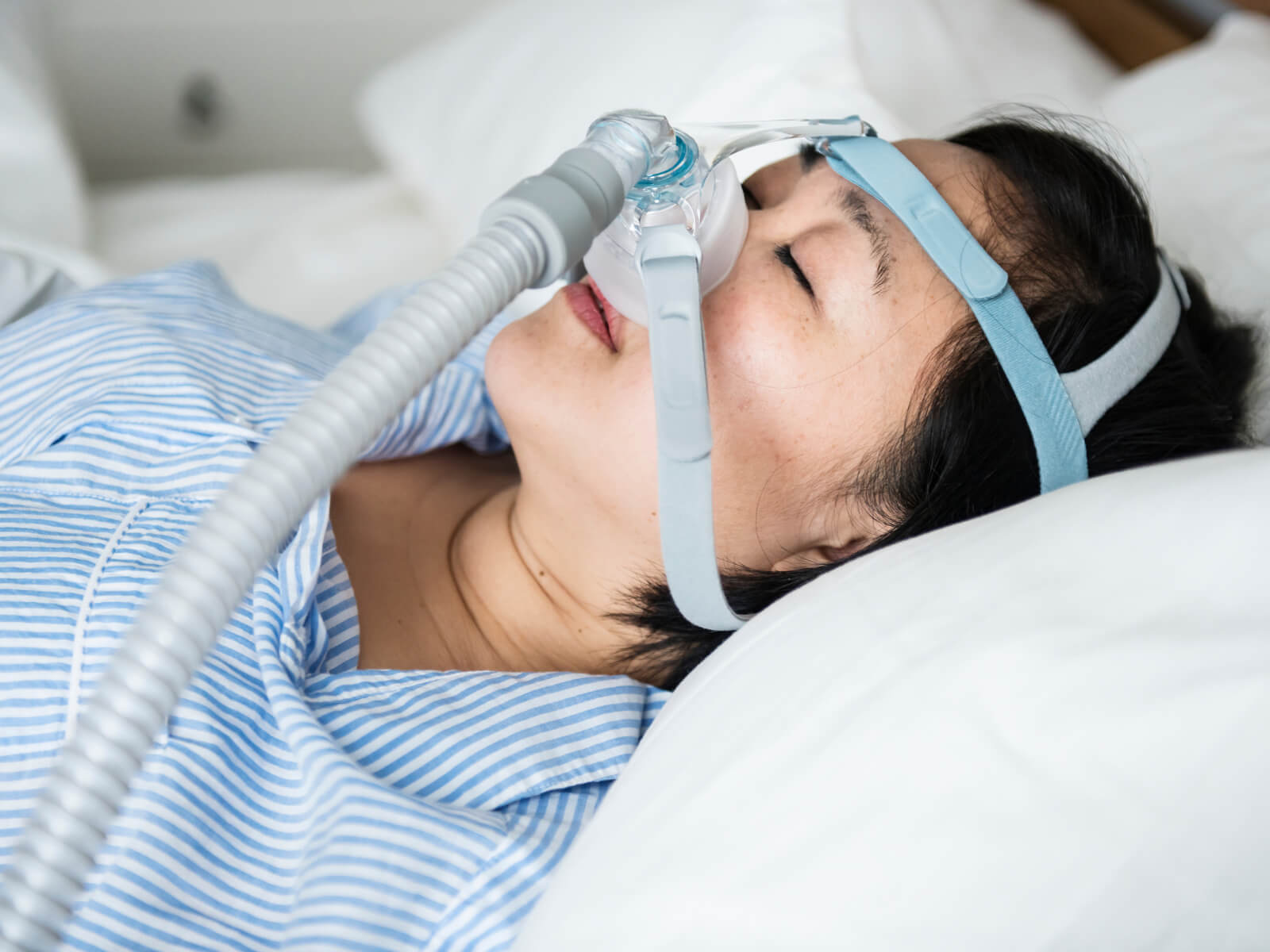 How Jaw Surgery Can Help Treat Severe Sleep Apnea