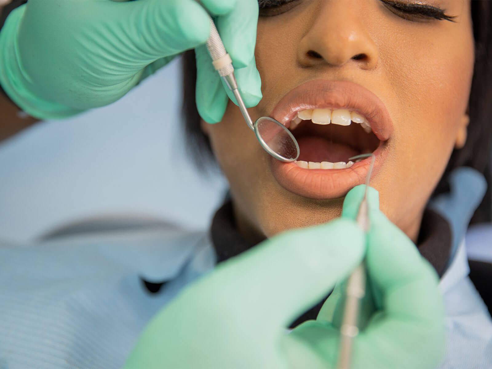 Dental Crown vs Filling: What’s the Differences
