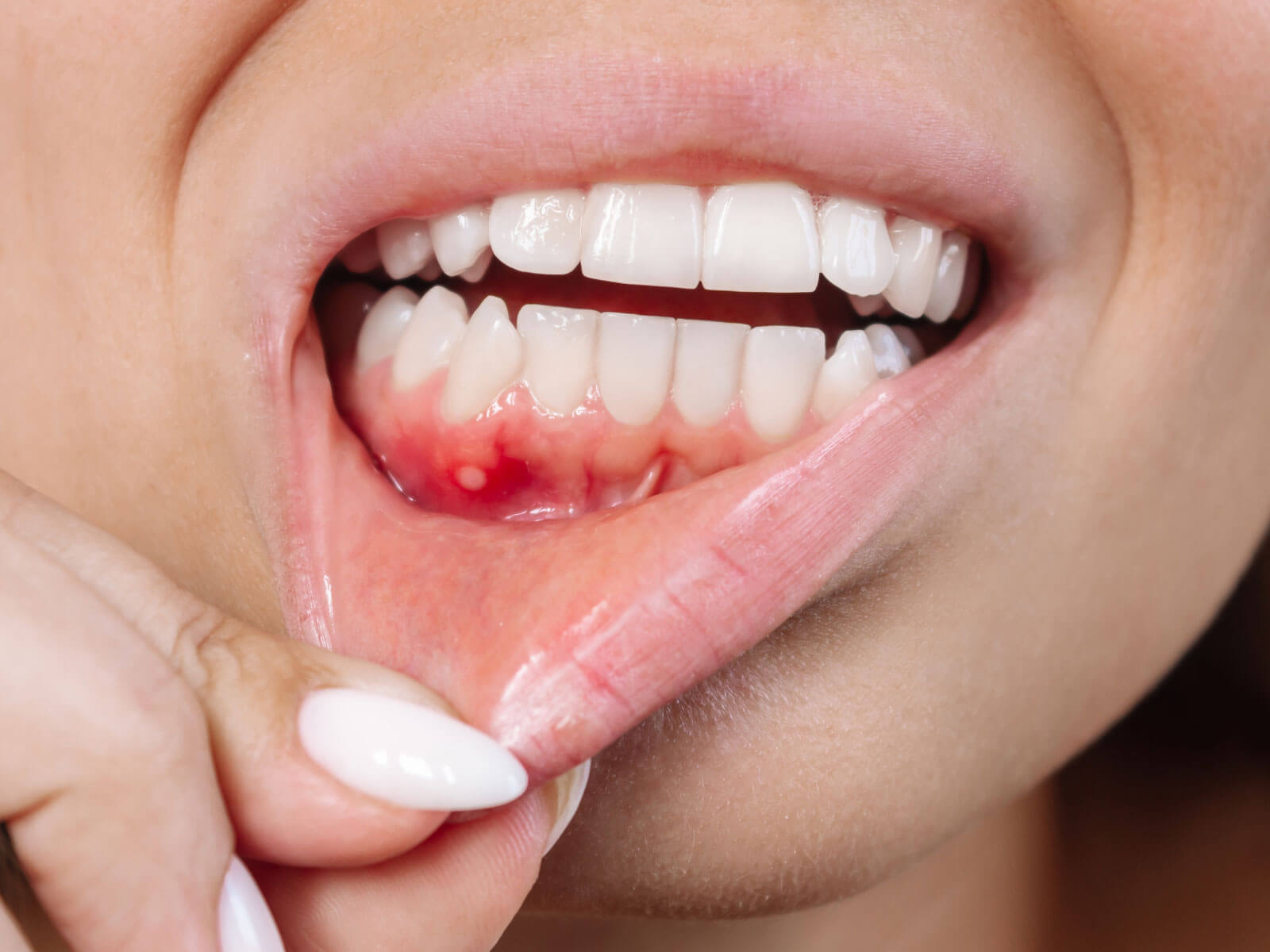 Gum Swelling: Causes, Symptoms, and Treatment Options