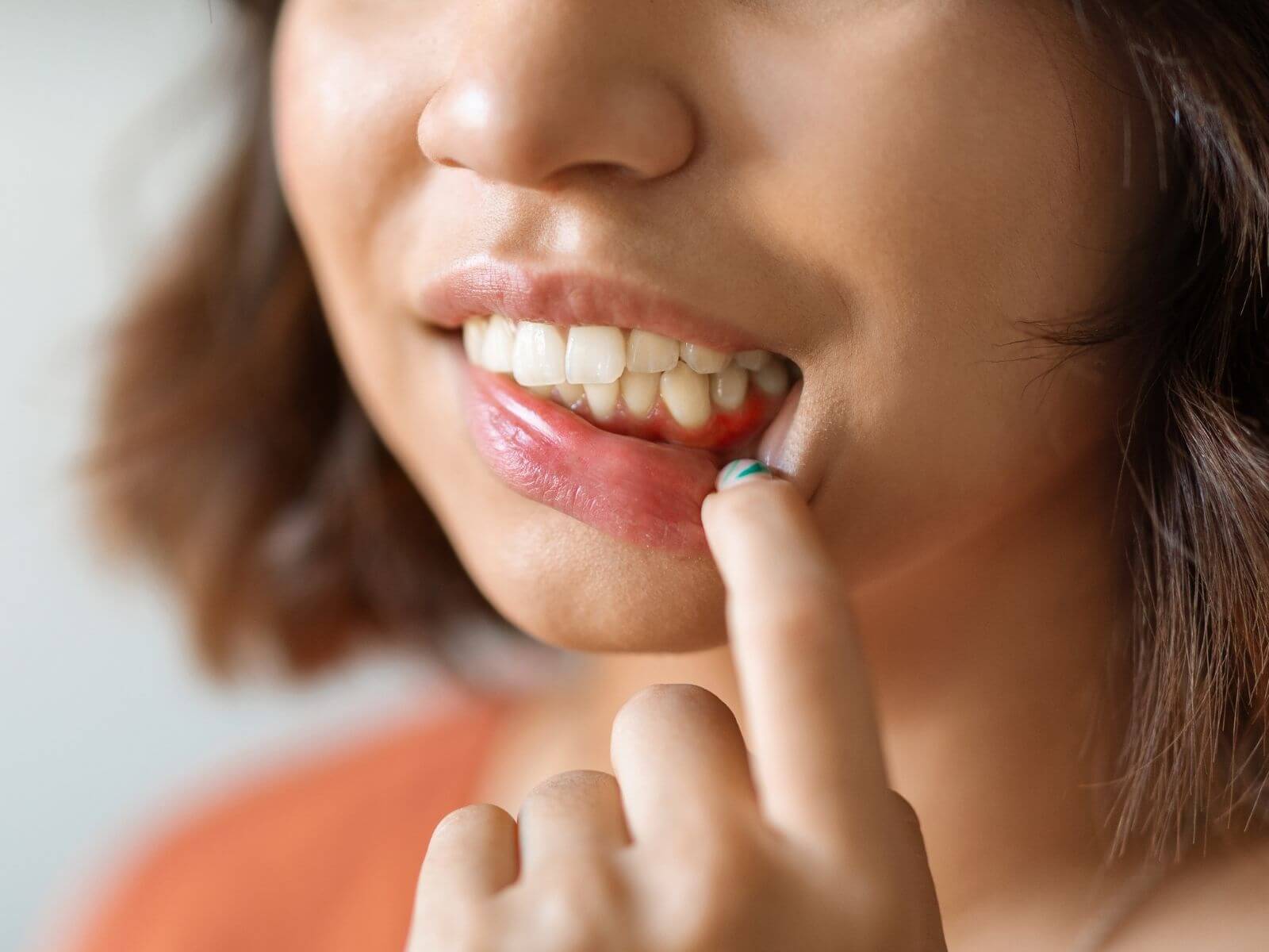 What Is Gum Disease? Stages, Symptoms, and Treatment Options