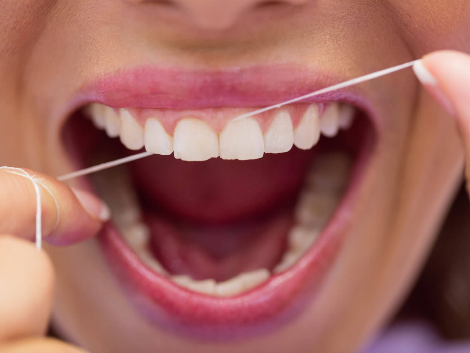 How to Brush and Floss With Braces: Step-by-Step Guide