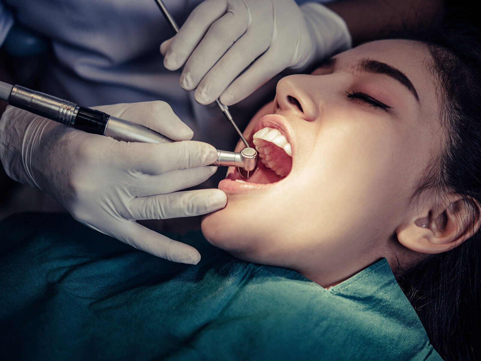 Signs You Need a Root Canal: What Your Dentist Looks For